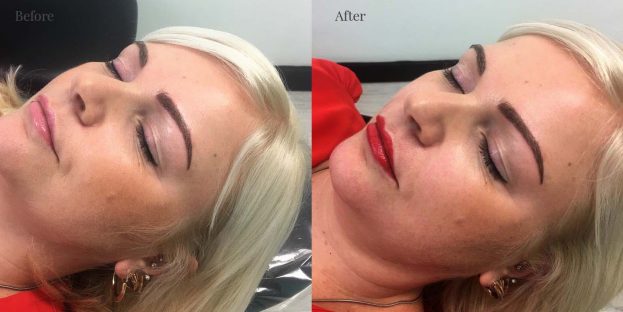 Client 1 After Full Lip Colour