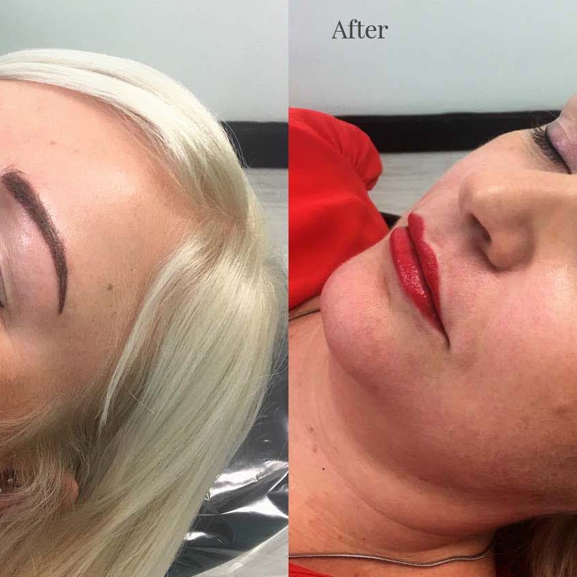 Client 1 After Full Lip Colour
