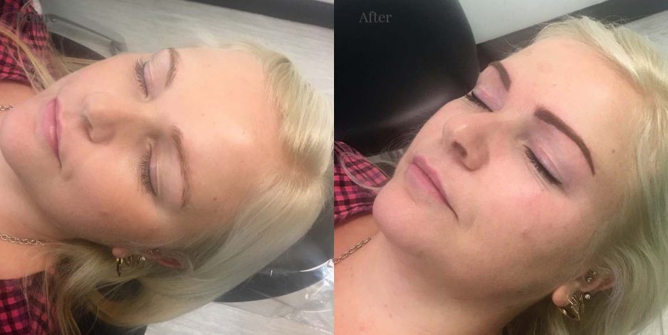 Client 1 Eyebrow after