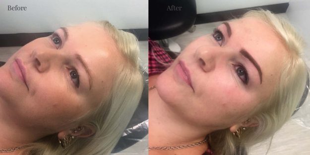Client 1 Eyeliner & eyelash enhancement after