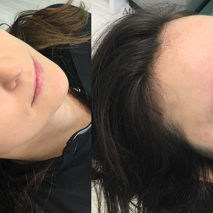 Client 2 after eyebrows