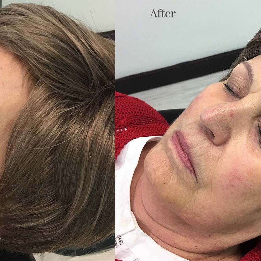 Client 3 after eyebrows