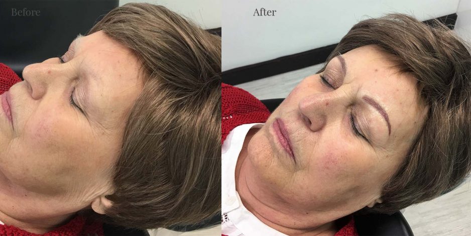 Client 3 after eyebrows
