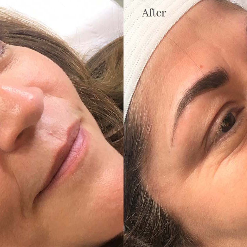 Client 4 after eyebrows