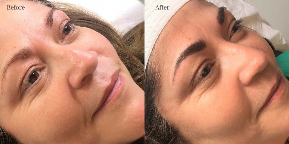 Client 4 after eyebrows