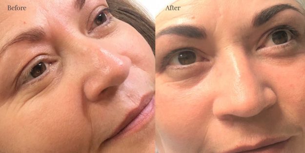 Tracey before & after Eyebrows and Eyelash Enchancement