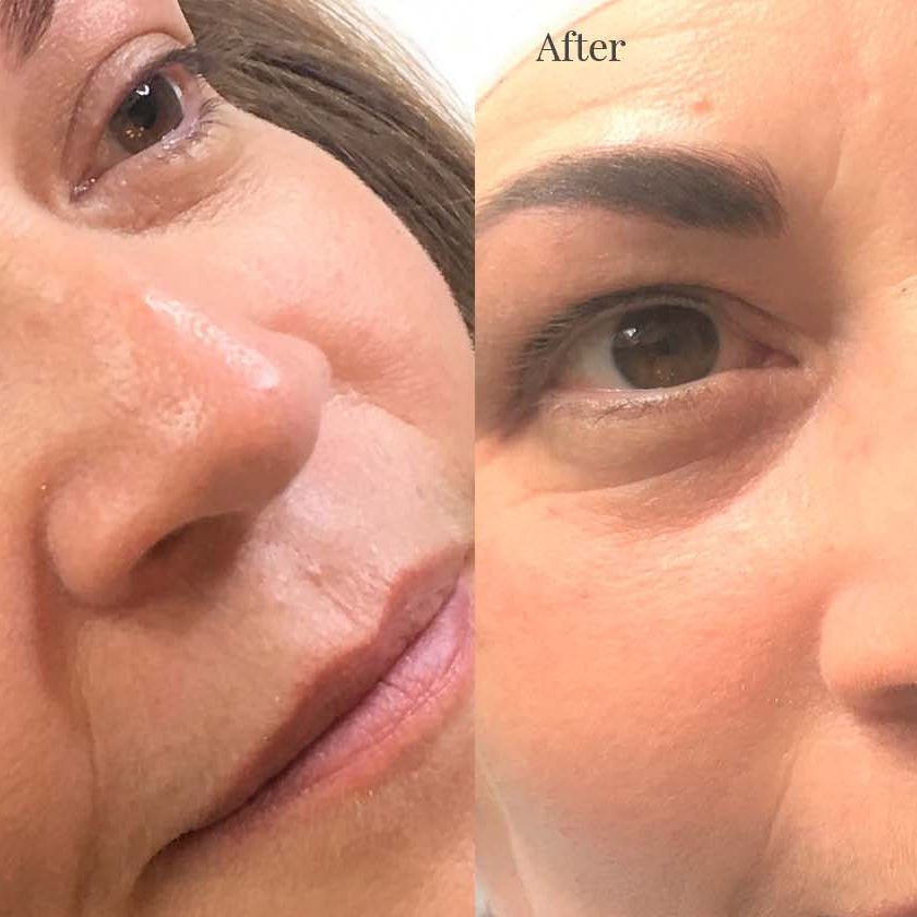 Tracey before & after Eyebrows and Eyelash Enchancement