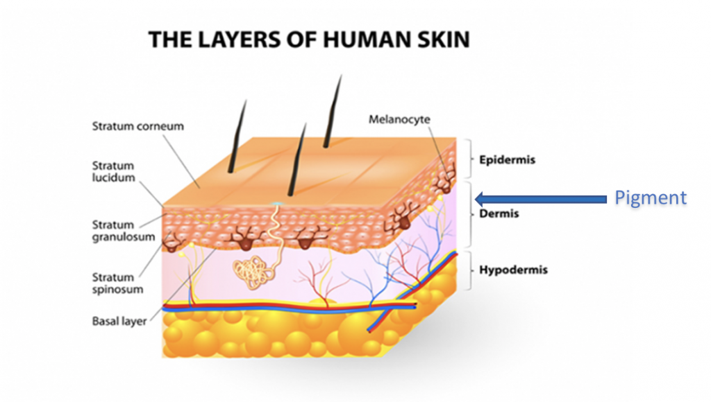 Layers of Human Skin and Permanent Makeup