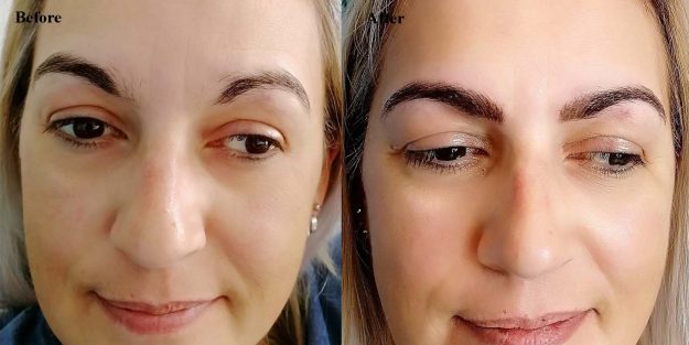 Sandra Before & After Permanent Eyebrows