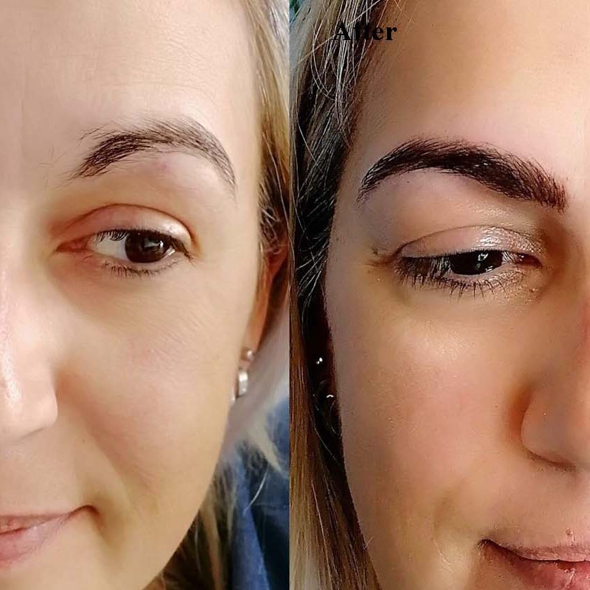 Sandra Before & After Permanent Eyebrows